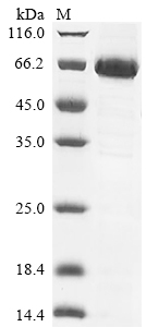 Recombinant Human Mothers against decapentaplegic homolog 6(SMAD6)