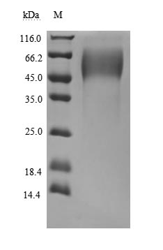 Recombinant Human Mucin-16(MUC16),partial (Active)