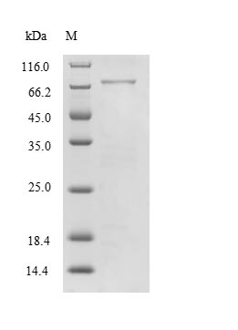 Recombinant Human Myelin-associated glycoprotein(MAG),partial