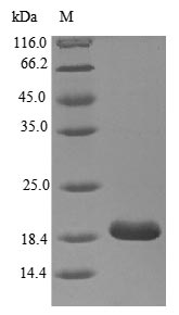 Recombinant Human Myelin protein P0(MPZ),partial 