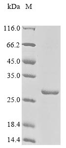 Recombinant Human Myocardin-related transcription factor A(MRTFA),partial