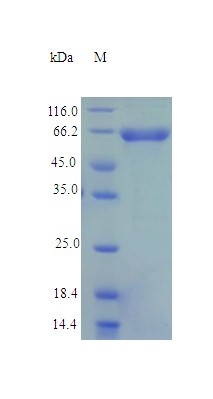 Recombinant Human NAD-dependent malic enzyme, mitochondrial protein(ME2) (Active)