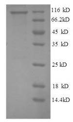 Recombinant Human NADPH--cytochrome P450 reductase(POR),partial