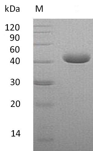 Recombinant Human Nectin-4(NECTIN4),partial (Active)