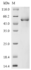 Recombinant Human Netrin-4(NTN4),partial
