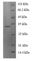 Recombinant Human Neuroglobin(NGB)