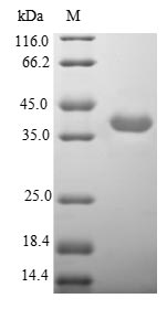 Recombinant Human Neuronal acetylcholine receptor subunit alpha-3 (CHRNA3),partial