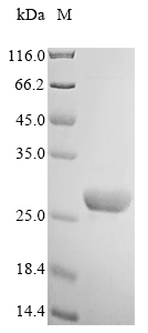 Recombinant Human Neuropeptide B(NPB)