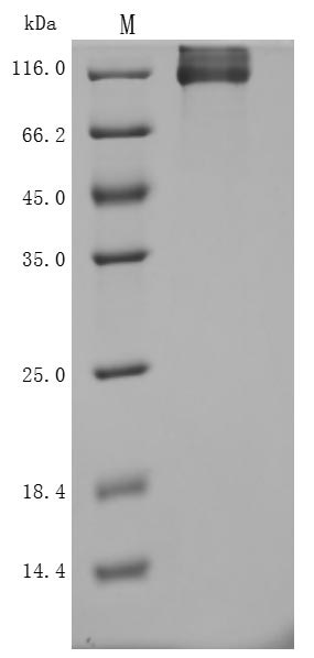 Recombinant Human Neuropilin-1(NRP1) (Active)