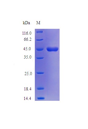 Recombinant Human Neuroserpin protein(SERPINI1) (Active)