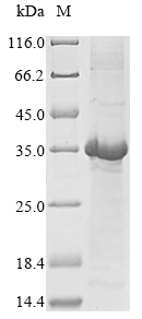 Recombinant Human Neutrophil defensin 1(DEFA1)