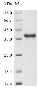 Recombinant Human Non-receptor tyrosine-protein kinase TYK2 (TYK2),partial