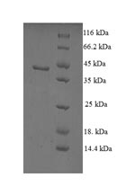 Recombinant Human Non-specific lipid-transfer protein(SCP2)