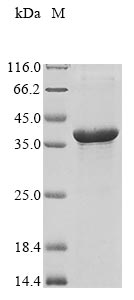 Recombinant Human Non-structural maintenance of chromosomes element 3 homolog(NSMCE3)