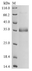 Recombinant Human Notch homolog 2 N-terminal-like protein B(NOTCH2NLB)