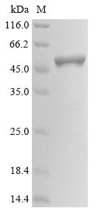 Recombinant Human Novel Coronavirus Nucleoprotein(N)(D103Y) (Active)