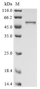 Recombinant Human Novel Coronavirus Nucleoprotein(N)(D3L,R203K,G204R,S235F) (Active)