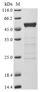Recombinant Human Novel Coronavirus Nucleoprotein(N)(I292T) (Active)