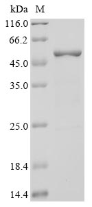 Recombinant Human Novel Coronavirus Nucleoprotein(N)(P13L) (Active)