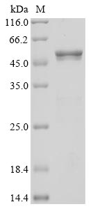 Recombinant Human Novel Coronavirus Nucleoprotein(N)(P80R) (Active)