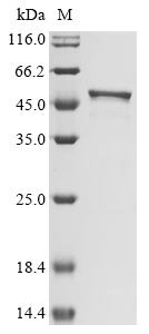 Recombinant Human Novel Coronavirus Nucleoprotein(N)(S202N) (Active)