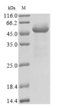 Recombinant Human Novel Coronavirus Nucleoprotein(N) (Active)