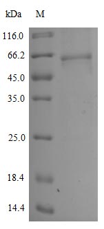 Recombinant Human Novel Coronavirus Spike glycoprotein(S) (E484K),partial (Active)