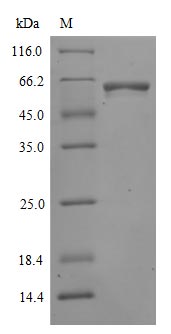 Recombinant Human Novel Coronavirus Spike glycoprotein(S) (N501Y),partial (Active)