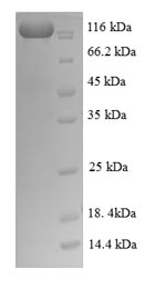 Recombinant Human Nuclear factor NF-kappa-B p105 subunit(NFKB1)