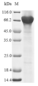 Recombinant Human Nuclear receptor ROR-gamma(RORC)