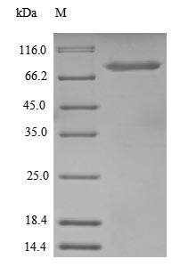 Recombinant Human Nucleolar transcription factor 1(UBTF),partial