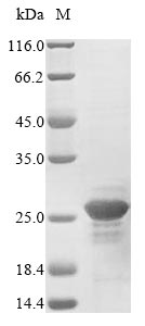 Recombinant Human Nucleoside diphosphate kinase B(NME2),partial