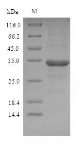 Recombinant Human Odorant-binding protein 2a(OBP2A)