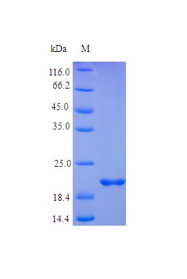 Recombinant Human Oncostatin-M protein(OSM) (Active)