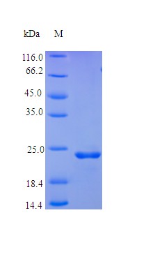 Recombinant Human Oncostatin-M protein(OSM) (Active)