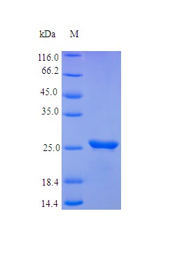 Recombinant Human Oncostatin-M protein(OSM) (Active)