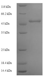 Recombinant Human Ornithine carbamoyltransferase, mitochondrial(OTC) 