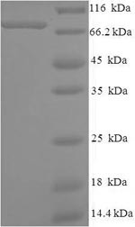 Recombinant Human PC4 and SFRS1-interacting protein(PSIP1)