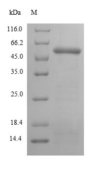 Recombinant Human Paraneoplastic antigen Ma2(PNMA2),partial