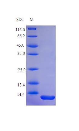 Recombinant Human Parathyroid hormone protein(PTH) (Active)