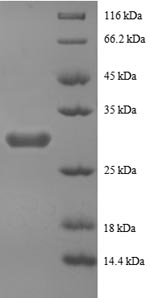 Recombinant Human Peptide YY protein(PYY),partial