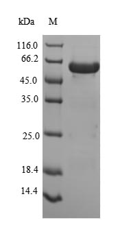 Recombinant Human Peroxisomal biogenesis factor 19(PEX19) (Active)