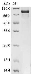 Recombinant Human Pescadillo homolog(PES1)