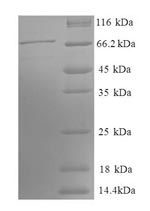 Recombinant Human Phosphoglycerate kinase 1(PGK1),partial