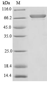 Recombinant Human Plasma alpha-L-fucosidase(FUCA2),partial