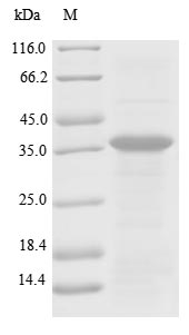 Recombinant Human Plasminogen(PLG),partial