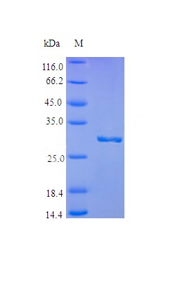 Recombinant Human Plasminogen protein(PLG) (Active)