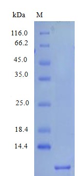 Recombinant Human Platelet basic protein(PPBP) (Active)