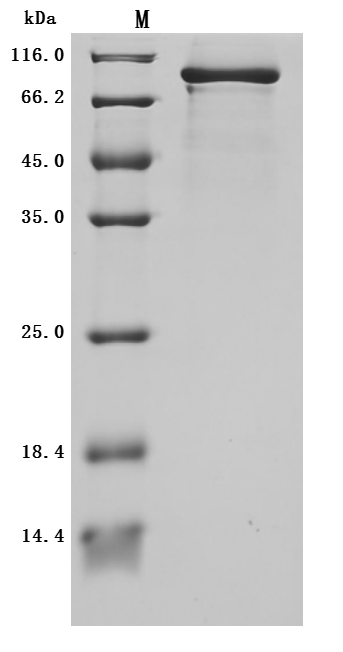 Recombinant Human Plexin-B1(PLXNB1),partial (Active)
