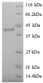 Recombinant Human Poly [ADP-ribose] polymerase 1(PARP11),partial